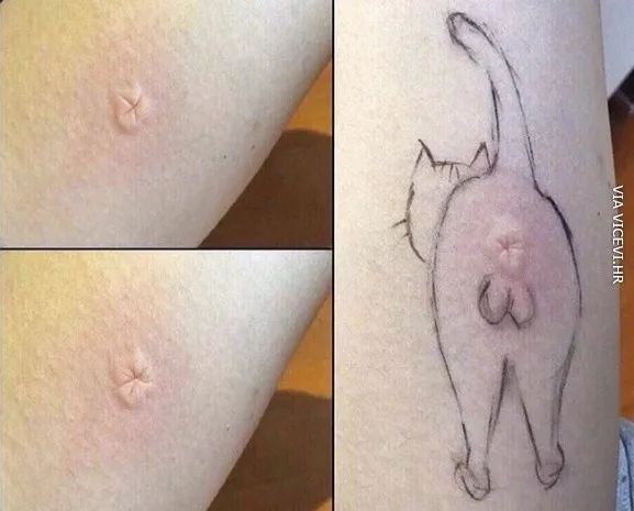 Najbolji način prikrivanja ugriza komarca